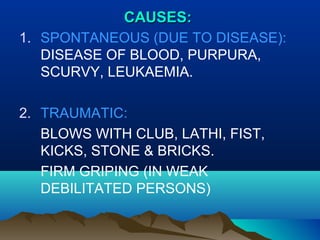 CCAAUUSSEESS:: 
1. SPONTANEOUS (DUE TO DISEASE): 
DISEASE OF BLOOD, PURPURA, 
SCURVY, LEUKAEMIA. 
2. TRAUMATIC: 
BLOWS WITH CLUB, LATHI, FIST, 
KICKS, STONE & BRICKS. 
FIRM GRIPING (IN WEAK 
DEBILITATED PERSONS) 
 