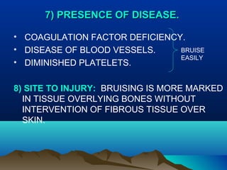 77)) PPRREESSEENNCCEE OOFF DDIISSEEAASSEE.. 
• COAGULATION FACTOR DEFICIENCY. 
• DISEASE OF BLOOD VESSELS. 
• DIMINISHED PLATELETS. 
BRUISE 
EASILY 
8) SITE TO INJURY: BRUISING IS MORE MARKED 
IN TISSUE OVERLYING BONES WITHOUT 
INTERVENTION OF FIBROUS TISSUE OVER 
SKIN. 
 