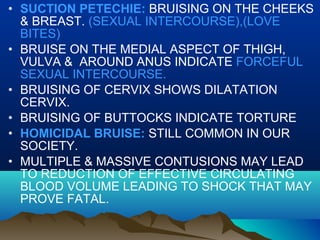 • SUCTION PETECHIE: BRUISING ON THE CHEEKS 
& BREAST. (SEXUAL INTERCOURSE),(LOVE 
BITES) 
• BRUISE ON THE MEDIAL ASPECT OF THIGH, 
VULVA & AROUND ANUS INDICATE FORCEFUL 
SEXUAL INTERCOURSE. 
• BRUISING OF CERVIX SHOWS DILATATION 
CERVIX. 
• BRUISING OF BUTTOCKS INDICATE TORTURE 
• HOMICIDAL BRUISE: STILL COMMON IN OUR 
SOCIETY. 
• MULTIPLE & MASSIVE CONTUSIONS MAY LEAD 
TO REDUCTION OF EFFECTIVE CIRCULATING 
BLOOD VOLUME LEADING TO SHOCK THAT MAY 
PROVE FATAL. 
 