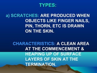 TTYYPPEESS:: 
a) SCRATCHES: ARE PRODUCED WHEN 
OBJECTS LIKE FINGER NAILS, 
PIN, THORN, ETC IS DRAWN 
ON THE SKIN. 
CHARACTERISTICS: A CLEAN AREA 
AT THE COMMENCEMENT & 
HEAPING UP OF SURFACE 
LAYERS OF SKIN AT THE 
TERMINATION. 
 