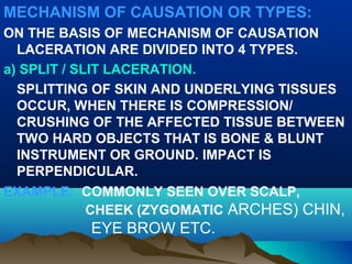 MECHANISM OF CAUSATION OR TYPES: 
ON THE BASIS OF MECHANISM OF CAUSATION 
LACERATION ARE DIVIDED INTO 4 TYPES. 
a) SPLIT / SLIT LACERATION. 
SPLITTING OF SKIN AND UNDERLYING TISSUES 
OCCUR, WHEN THERE IS COMPRESSION/ 
CRUSHING OF THE AFFECTED TISSUE BETWEEN 
TWO HARD OBJECTS THAT IS BONE & BLUNT 
INSTRUMENT OR GROUND. IMPACT IS 
PERPENDICULAR. 
EXAMPLE: COMMONLY SEEN OVER SCALP, 
CHEEK (ZYGOMATIC ARCHES) CHIN, 
EYE BROW ETC. 
 