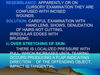 RESEMBLANCE: APPARENTLY OR ON 
CURSORY EXAMINATION THEY ARE 
CONFUSED WITH INCISED 
WOUNDS. 
SOLUTION: CAREFUL EXAMINATION WITH 
HAND LENS, SHOWS, DENUDATION 
OF HAIRS NOT CUTTING, 
IRREGULAR EDGES WITH 
BRUISING. 
b) OVER STRETCHING OF SKIN: 
THERE IS LOCALIZED PRESSURE WITH 
PULL, WHICH INCREASES UNTIL TEARING 
OCCURS PRODUCING A FLAP INDICATING 
DIRECTION OF THE OFFENDING OBJECT, 
IMPACT IS TANGENTIAL. 
 