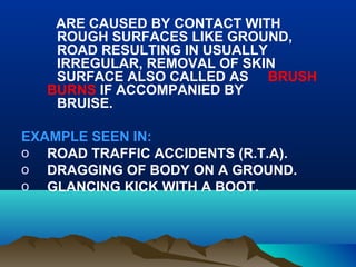 ARE CAUSED BY CONTACT WITH 
ROUGH SURFACES LIKE GROUND, 
ROAD RESULTING IN USUALLY 
IRREGULAR, REMOVAL OF SKIN 
SURFACE ALSO CALLED AS BRUSH 
BURNS IF ACCOMPANIED BY 
BRUISE. 
EXAMPLE SEEN IN: 
o ROAD TRAFFIC ACCIDENTS (R.T.A). 
o DRAGGING OF BODY ON A GROUND. 
o GLANCING KICK WITH A BOOT. 
 