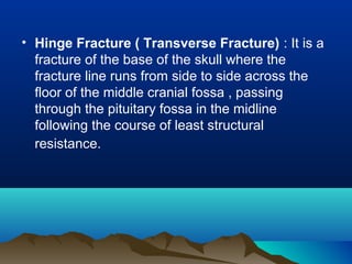 • Hinge Fracture ( Transverse Fracture) : It is a 
fracture of the base of the skull where the 
fracture line runs from side to side across the 
floor of the middle cranial fossa , passing 
through the pituitary fossa in the midline 
following the course of least structural 
resistance. 
 