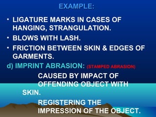 EEXXAAMMPPLLEE:: 
• LIGATURE MARKS IN CASES OF 
HANGING, STRANGULATION. 
• BLOWS WITH LASH. 
• FRICTION BETWEEN SKIN & EDGES OF 
GARMENTS. 
d) IMPRINT ABRASION: (STAMPED ABRASION) 
CAUSED BY IMPACT OF 
OFFENDING OBJECT WITH 
SKIN. 
REGISTERING THE 
IMPRESSION OF THE OBJECT. 
 