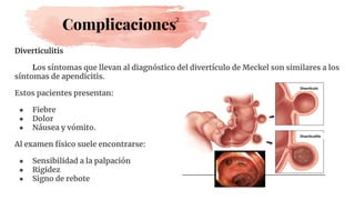 Complicaciones
Diverticulitis
Los síntomas que llevan al diagnóstico del divertículo de Meckel son similares a los
síntomas de apendicitis.
Estos pacientes presentan:
● Fiebre
● Dolor
● Náusea y vómito.
Al examen físico suele encontrarse:
● Sensibilidad a la palpación
● Rigidez
● Signo de rebote
2
 