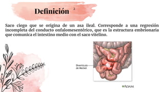 Deﬁnición
Saco ciego que se origina de un asa ileal. Corresponde a una regresión
incompleta del conducto onfalomesentérico, que es la estructura embrionaria
que comunica el intestino medio con el saco vitelino.
2
 