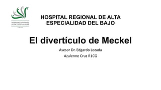 HOSPITAL REGIONAL DE ALTA
ESPECIALIDAD DEL BAJO
El divertículo de Meckel
Asesor Dr. Edgardo Lozada
Azulenne Cruz R1CG
 