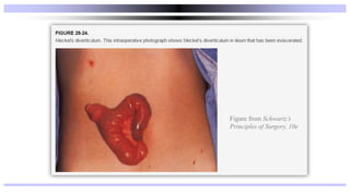 Figure from Schwartz’s
Principles of Surgery, 10e
 