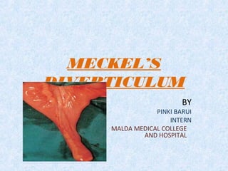 MECKEL’S
DIVERTICULUM
BY
PINKI BARUI
INTERN
MALDA MEDICAL COLLEGE
AND HOSPITAL
 