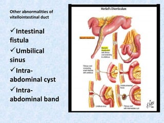 Other abnormalities of
vitellointestinal duct
Intestinal
fistula
Umbilical
sinus
Intra-
abdominal cyst
Intra-
abdominal band
 