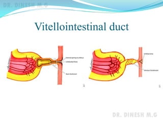 Vitellointestinal duct
 