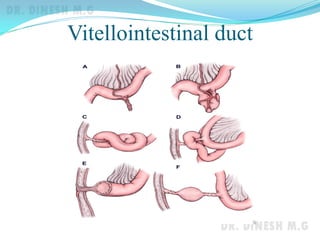 Vitellointestinal duct
 