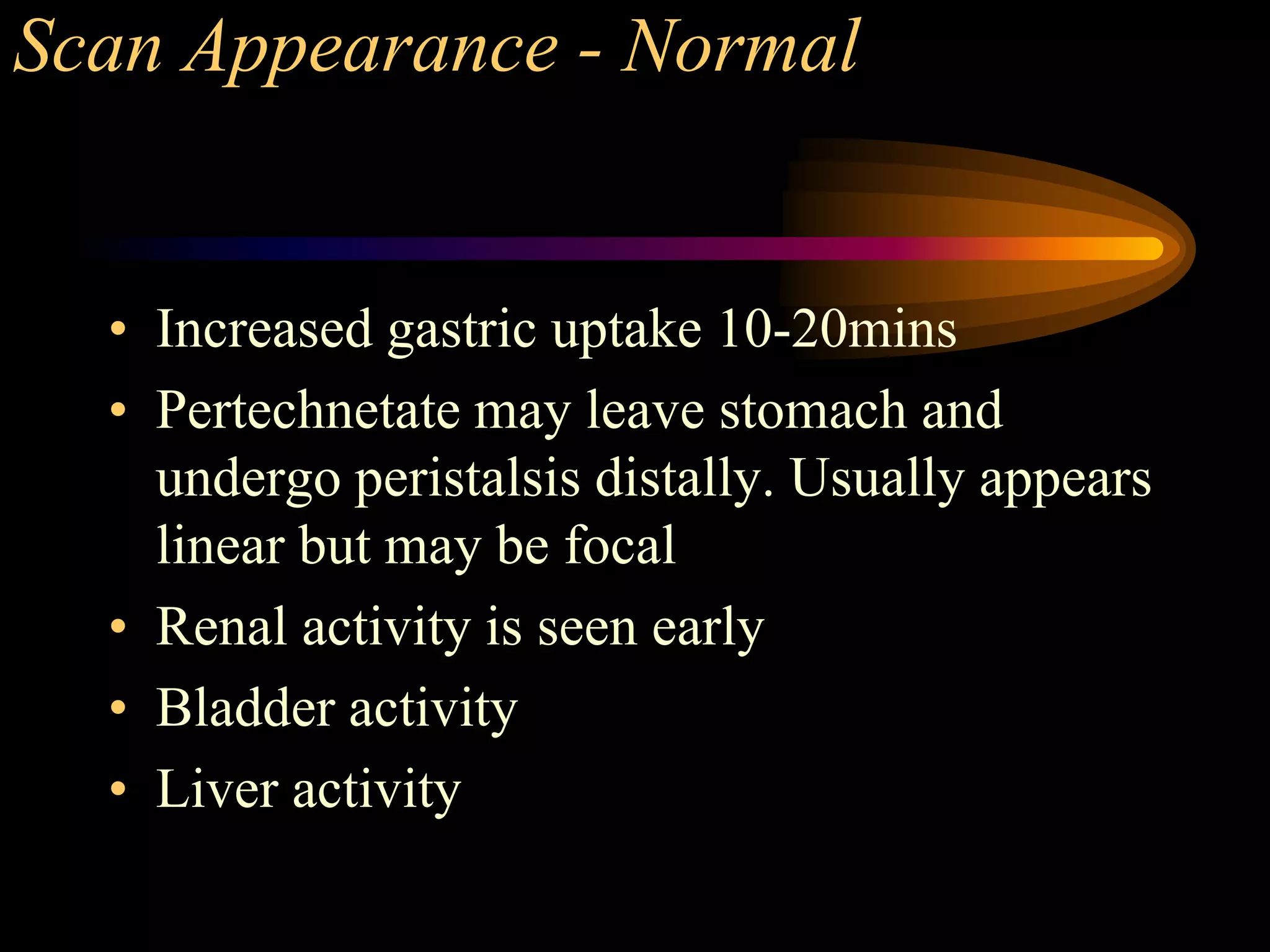 Meckels diverticulum - a nuclear medicine case study | PDF