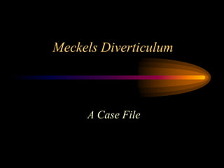 Meckels Diverticulum



     A Case File
 