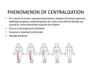 PHENOMENON OF CENTRALIZATION
• As a result of certain repeated movements/ adoption of certain postures,
radiating symptoms originating from the spine and referred distally are
caused to move proximally towards the midline.
• Occurs in derangement syndrome
• Increase in localized central pain
• Reliable predictor
 