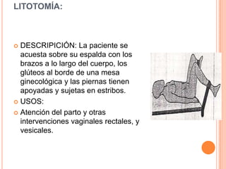 LITOTOMÍA:



 DESCRIPICIÓN: La paciente se
  acuesta sobre su espalda con los
  brazos a lo largo del cuerpo, los
  glúteos al borde de una mesa
  ginecológica y las piernas tienen
  apoyadas y sujetas en estribos.
 USOS:

 Atención del parto y otras
  intervenciones vaginales rectales, y
  vesicales.
 
