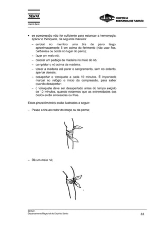 Espírito Santo
___________________________________________________________________________________________________
___________________________________________________________________________________________________
SENAI
Departamento Regional do Espírito Santo 83
• se compressão não for suficiente para estancar a hemorragia,
aplicar o torniquete, da seguinte maneira:
− enrolar no membro uma tira de pano largo,
aproximadamente 5 cm acima do ferimento (não usar fios,
barbantes ou corda no lugar do pano);
− fazer um meio nó;
− colocar um pedaço de madeira no meio do nó;
− completar o nó acima da madeira;
− torcer a madeira até parar o sangramento, sem no entanto,
apertar demais;
− desapertar o torniquete a cada 10 minutos. É importante
marcar no relógio o início da compressão, para saber
quando desapertar;
− o torniquete deve ser desapertado antes do tempo exigido
de 10 minutos, quando notarmos que as extremidades dos
dedos estão arroxeadas ou frias.
Estes procedimentos estão ilustrados a seguir:
− Passe a tira ao redor do braço ou da perna;
− Dê um meio nó;
 