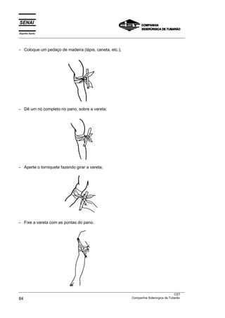 Espírito Santo
___________________________________________________________________________________________________
___________________________________________________________________________________________________
CST
84 Companhia Siderúrgica de Tubarão
− Coloque um pedaço de madeira (lápis, caneta, etc.);
− Dê um nó completo no pano, sobre a vareta;
− Aperte o torniquete fazendo girar a vareta;
− Fixe a vareta com as pontas do pano.
 