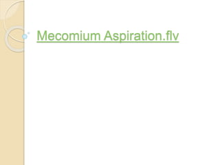 Mecomium Aspiration.flv
 