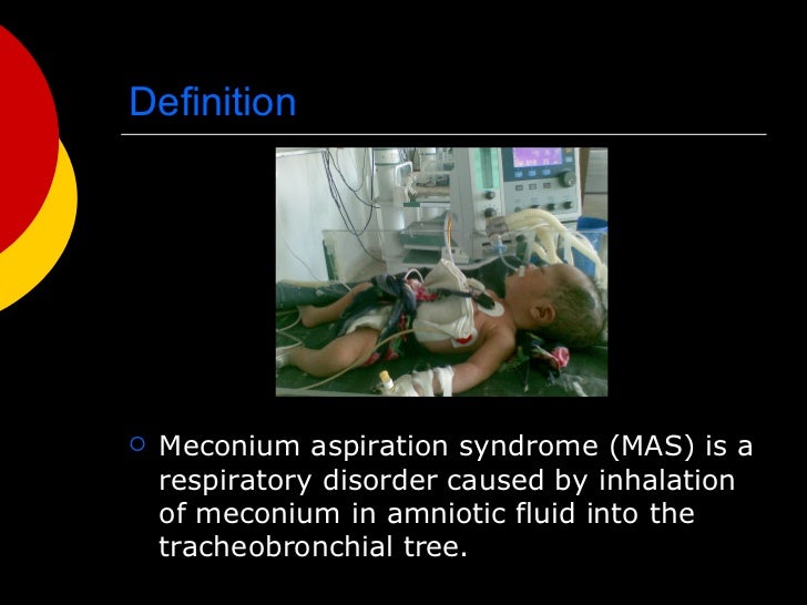 Meconium aspiration syndrome