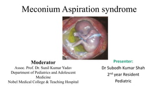 Meconium Aspiration syndrome
Moderator
Assoc. Prof. Dr. Sunil Kumar Yadav
Department of Pediatrics and Adolescent
Medicine
Nobel Medical College & Teaching Hospital
Presenter:
Dr Subodh Kumar Shah
2nd year Resident
Pediatric
 
