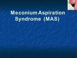 Meconium Aspiration
Syndrome (MAS)
 