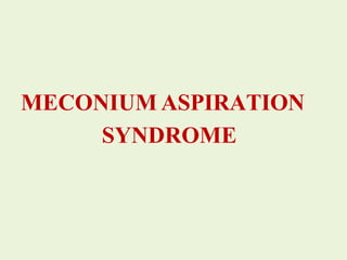 MECONIUM ASPIRATION
SYNDROME
 