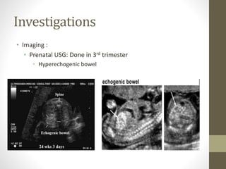 Investigations
• Imaging :
• Prenatal USG: Done in 3rd trimester
• Hyperechogenic bowel
 