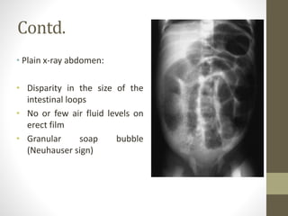 Contd.
• Plain x-ray abdomen:
• Disparity in the size of the
intestinal loops
• No or few air fluid levels on
erect film
• Granular soap bubble
(Neuhauser sign)
 