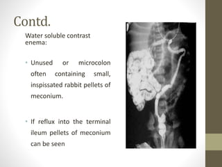 Contd.
Water soluble contrast
enema:
• Unused or microcolon
often containing small,
inspissated rabbit pellets of
meconium.
• If reflux into the terminal
ileum pellets of meconium
can be seen
 