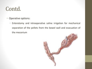 Contd.
• Operative options:
• Enterotomy and intraoperative saline irrigation for mechanical
separation of the pellets from the bowel wall and evacuation of
the meconium
 