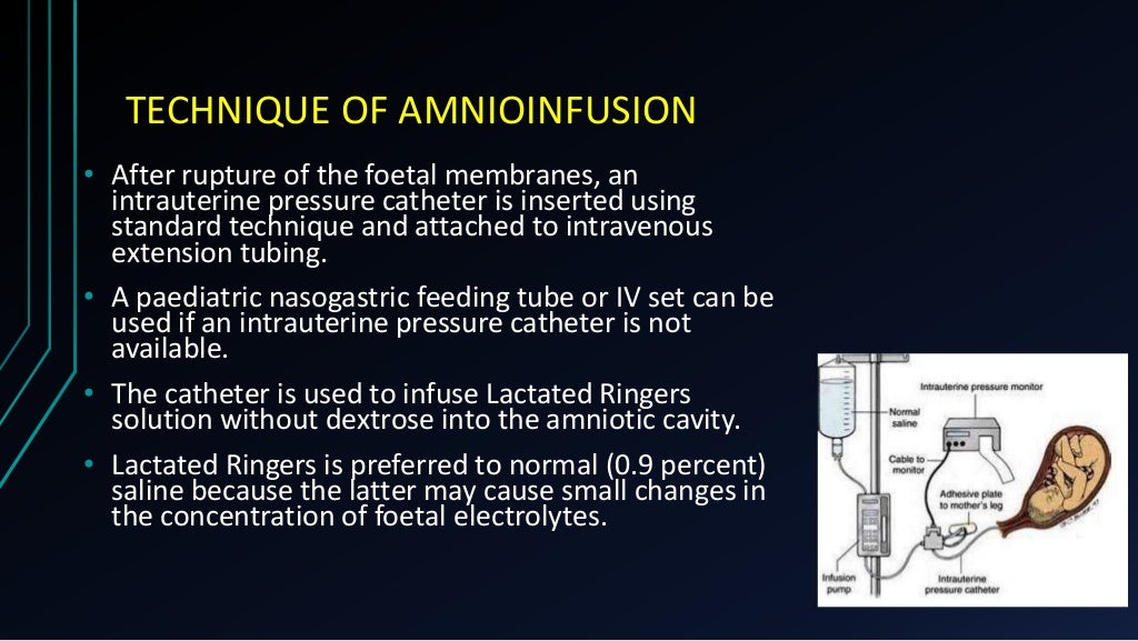MECONIUM STAINED AMNIOTIC FLUID