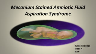 Meconium Stained Amniotic Fluid
Aspiration Syndrome
Rusila Tikoitoga
MBBS 4
2016
 