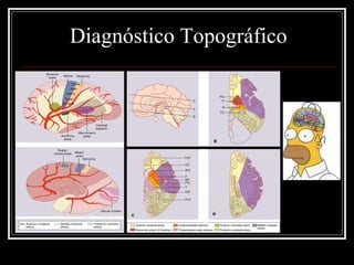 Diagnóstico Topográfico 