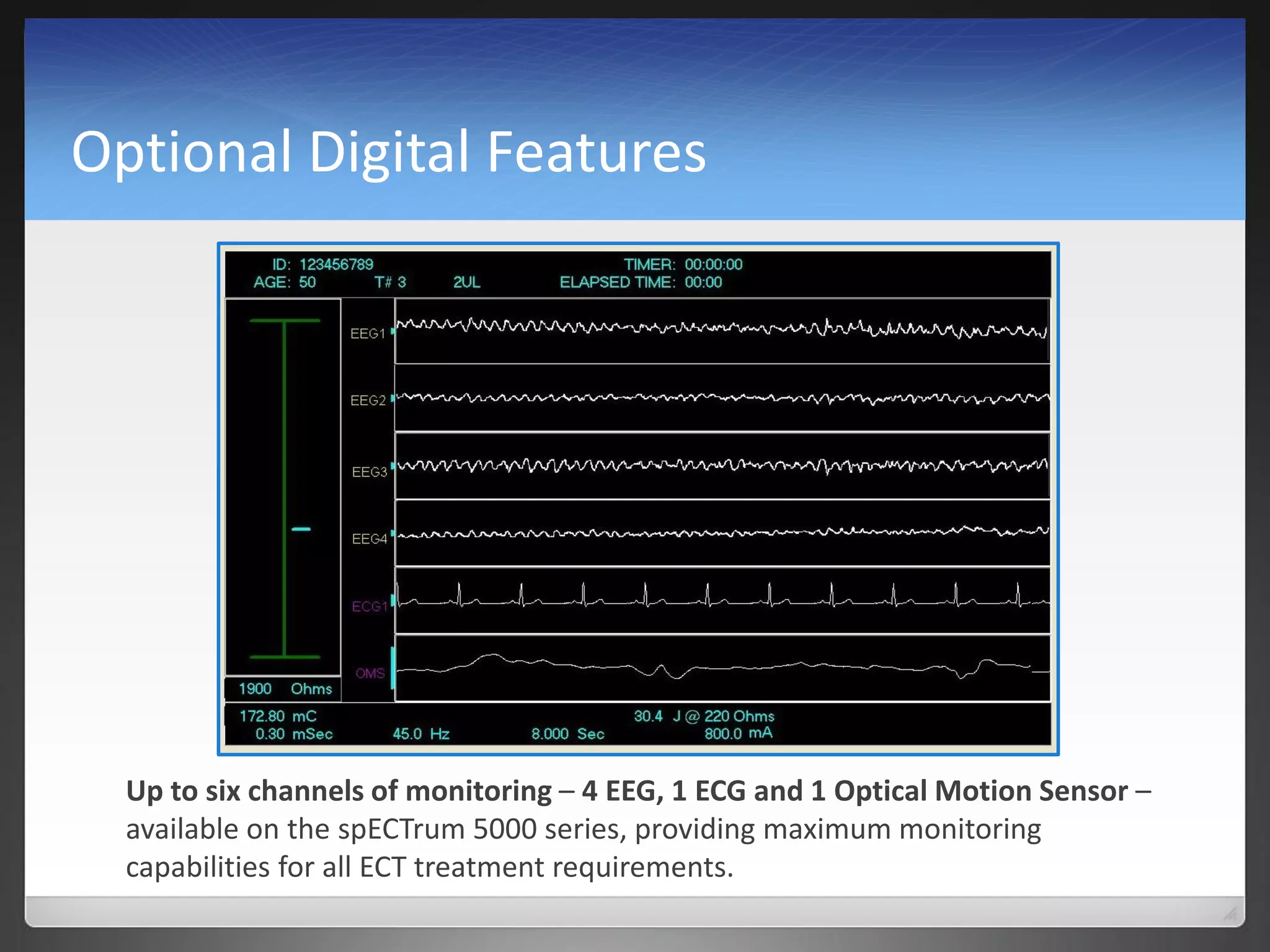 Optional Digital Features
Up to six channels of monitoring – 4 EEG, 1 ECG and 1 Optical Motion Sensor –
available on the spECTrum 5000 series, providing maximum monitoring
capabilities for all ECT treatment requirements.
 