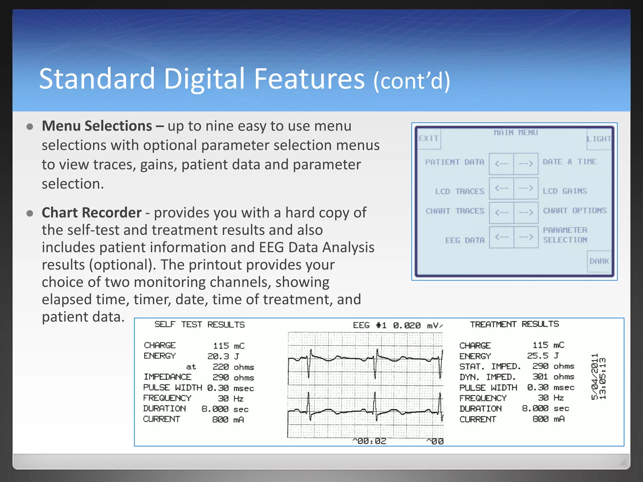 Standard Digital Features (cont’d)
 Menu Selections – up to nine easy to use menu
selections with optional parameter selection menus
to view traces, gains, patient data and parameter
selection.
 Chart Recorder - provides you with a hard copy of
the self-test and treatment results and also
includes patient information and EEG Data Analysis
results (optional). The printout provides your
choice of two monitoring channels, showing
elapsed time, timer, date, time of treatment, and
patient data.
 
