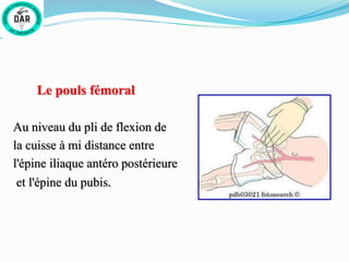 Le pouls fémoral
Au niveau du pli de flexion de
la cuisse à mi distance entre
l'épine iliaque antéro postérieure
et l'épine du pubis.
 