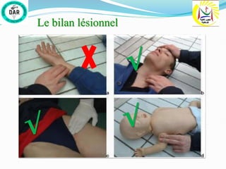 Le bilan lésionnel
√
√
√
 