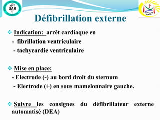 Défibrillation externe
 Indication: arrêt cardiaque en
- fibrillation ventriculaire
- tachycardie ventriculaire
 Mise en place:
- Electrode (-) au bord droit du sternum
- Electrode (+) en sous mamelonnaire gauche.
 Suivre les consignes du défibrillateur externe
automatisé (DEA)
 