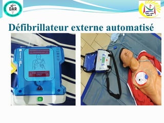 Défibrillateur externe automatisé
 