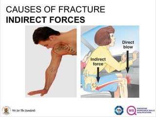 (MED 316) Management Of Fractures latest.pdf