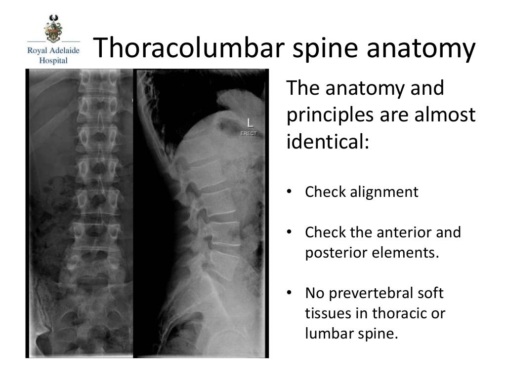 RAH Med 4 Ortho Spinal Imaging