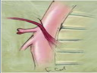 The median arcuate ligament is a fibrous arch unites the diaphragmatic crura .