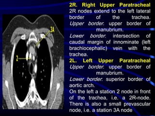 2R. Right Upper Paratracheal
2R nodes extend to the left lateral
border
of
the
trachea.
Upper border: upper border of
manubrium.
Lower border: intersection of
caudal margin of innominate (left
brachiocephalic) vein with the
trachea.
2L. Left Upper Paratracheal
Upper border: upper border of
manubrium.
Lower border: superior border of
aortic arch.
On the left a station 2 node in front
of the trachea, i.e. a 2R-node.
There is also a small prevascular
node, i.e. a station 3A node

 