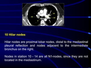 10 Hilar nodes
Hilar nodes are proximal lobar nodes, distal to the mediastinal
pleural reflection and nodes adjacent to the intermediate
bronchus on the right.
Nodes in station 10 - 14 are all N1-nodes, since they are not
located in the mediastinum.

 