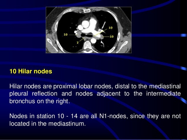 Medastinal lymphadenopathy