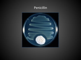 Penicillin
 