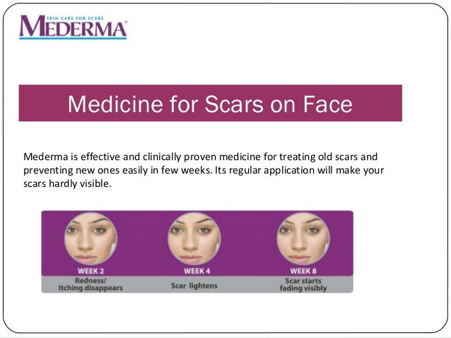 mederma for old stretch marks