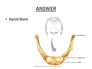 ANSWER
• Hyoid Bone
 